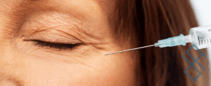How Do Dermal Fillers Work for Wrinkles?