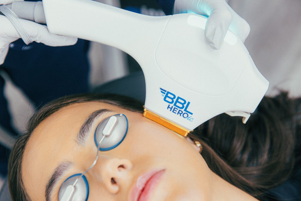 A provider gently presses the BBL HEROic device to a patient's cheek while the patient wears eye coverings to protect their sight during treatment for BBL laser near Cincinnati.