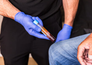 A Dermatology Aesthetics of Northern Kentucky provider shows a male patient the platelet-rich fibrin solution we use for PRF injections near Cincinnati.